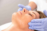 Theraderm NuPeel Natural Enzyme