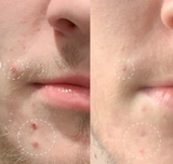 Face Reality Sulfur Spot Treatment – image 2